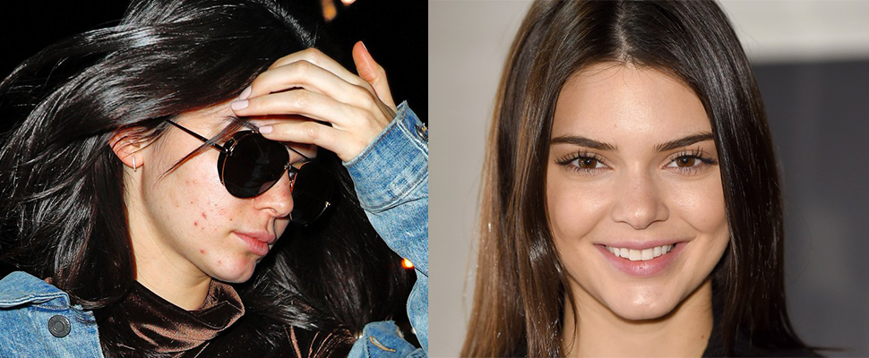 換季大冒痘金小妹也中招，跟著4步驟做擺脫痘花妹稱號吧！